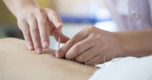 鍼灸の効果ってどうなの？