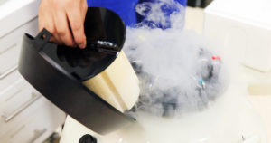 卵子凍結（社会的適応）される方からよくある質問